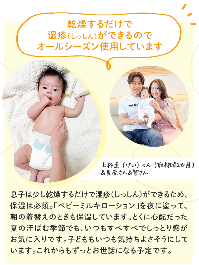 乾燥するだけで 湿疹（しっしん）ができるので オールシーズン使用しています／上杉圭（けい）くん（取材時2カ月）&見奈さん&智さん／息子は少し乾燥するだけで湿疹（しっしん）ができるため、保湿は必須。「ベビーミルキローション」を夜に塗って、朝の着替えのときも保湿しています。とくに心配だった夏の汗ばむ季節でも、いつもすべすべでしっとり感がお気に入りです。子どももいつも気持ちよさそうにしています。これからもずっとお世話になる予定です。