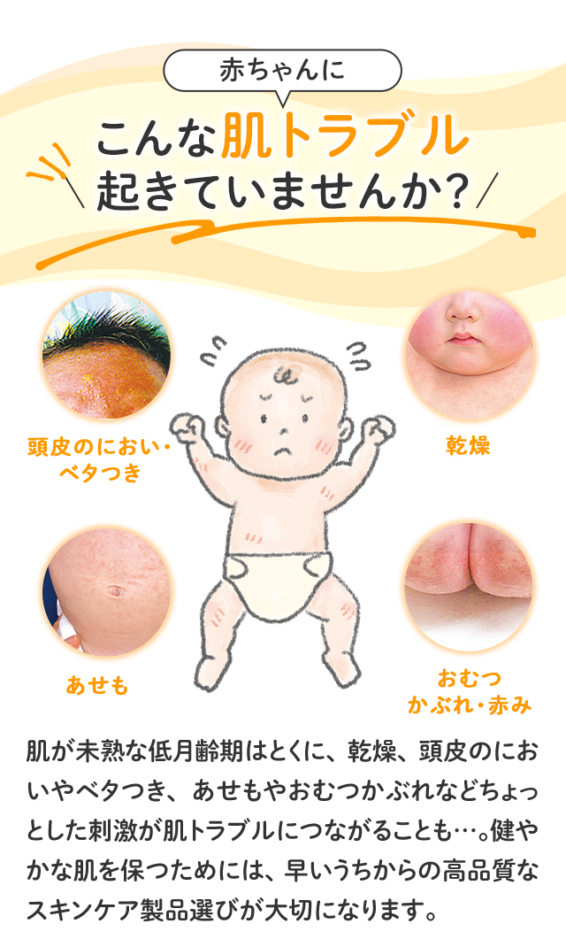 赤ちゃんにこんな肌トラブル起きていませんか？／頭皮のにおい・ベタつき／乾燥／あせも／おむつかぶれ・赤み／肌が未熟な低月齢期はとくに、乾燥、頭皮のにおいやベタつき、あせもやおむつかぶれなどちょっとした刺激が肌トラブルにつながることも…。健やかな肌を保つためには、早いうちからの高品質なスキンケア製品選びが大切になります。