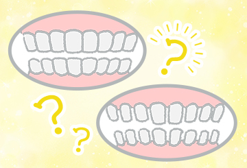 【クイズ】将来 “よい歯並び” になるのはどちら？正しい噛み方とは？歯科矯正の専門家に聞きました