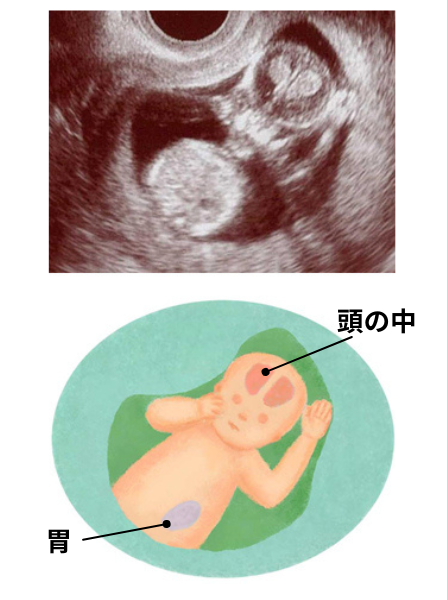 妊娠12週目の胎児の様子