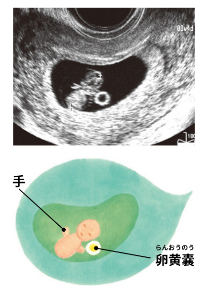 妊娠8週目の赤ちゃんの様子